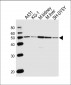 CLN3 Antibody (Center)